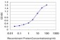 RPS6KB2 / S6K2 Antibody (clone 4B11)